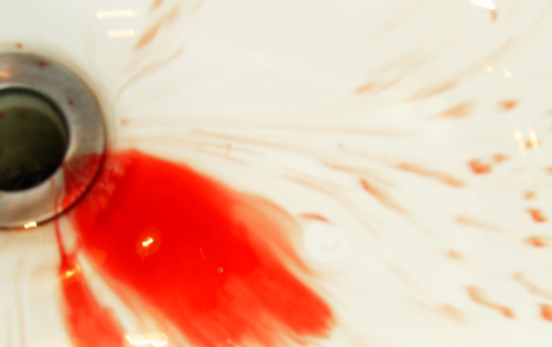 Doug Bolden's noseblood dripping into a sink