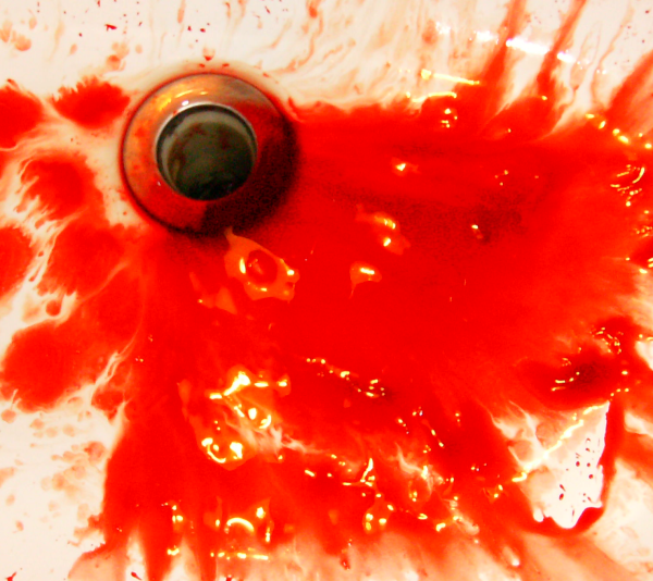 Doug Bolden's noseblood dripping into a sink